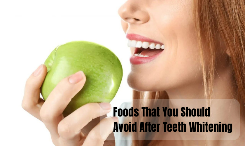 Foods That You Should Avoid After Teeth Whitening