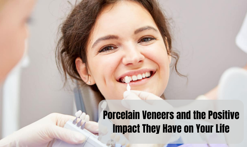 Porcelain Veneers