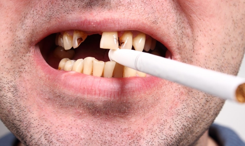 Unmasking the Truth: How Smoking Wreaks Havoc on Your Dental Health