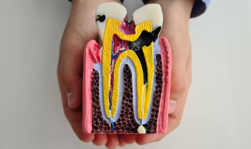 What to Do If a Root Canal Gets Infected?