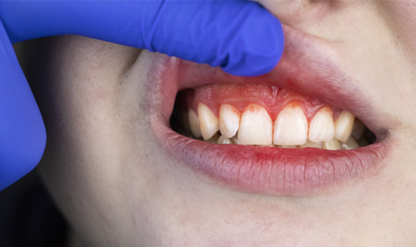 The Future of Periodontal Treatment: Innovations and Breakthroughs